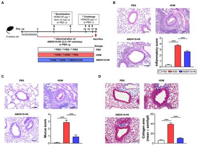 Heat-killed Akkermansia muciniphila ameliorates allergic airway inflammation in mice